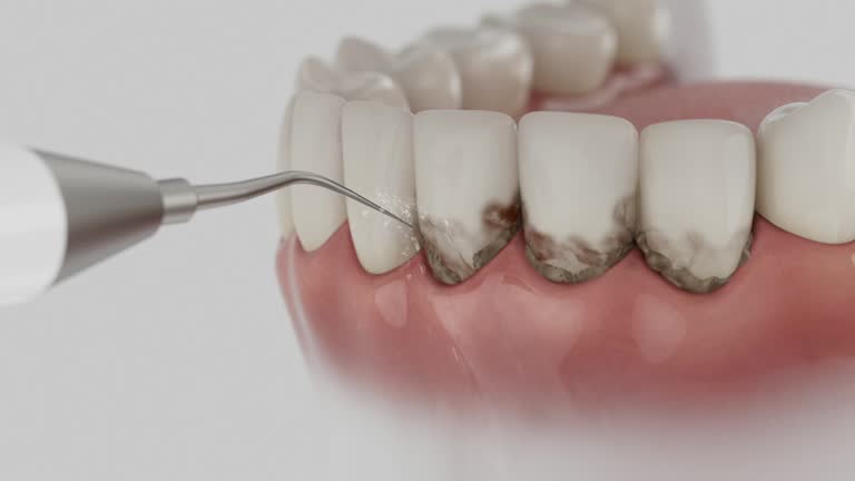 Reliable Dental contractor in Tilden, NE by Smile Center Dentistry